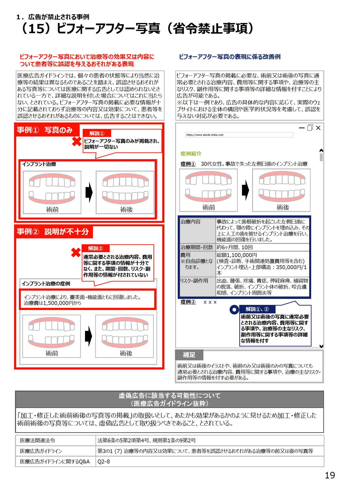 (15)ビフォーアフター写真(省令禁止事項) - 医療広告規制におけるウェブサイトの事例解説書(第2版)