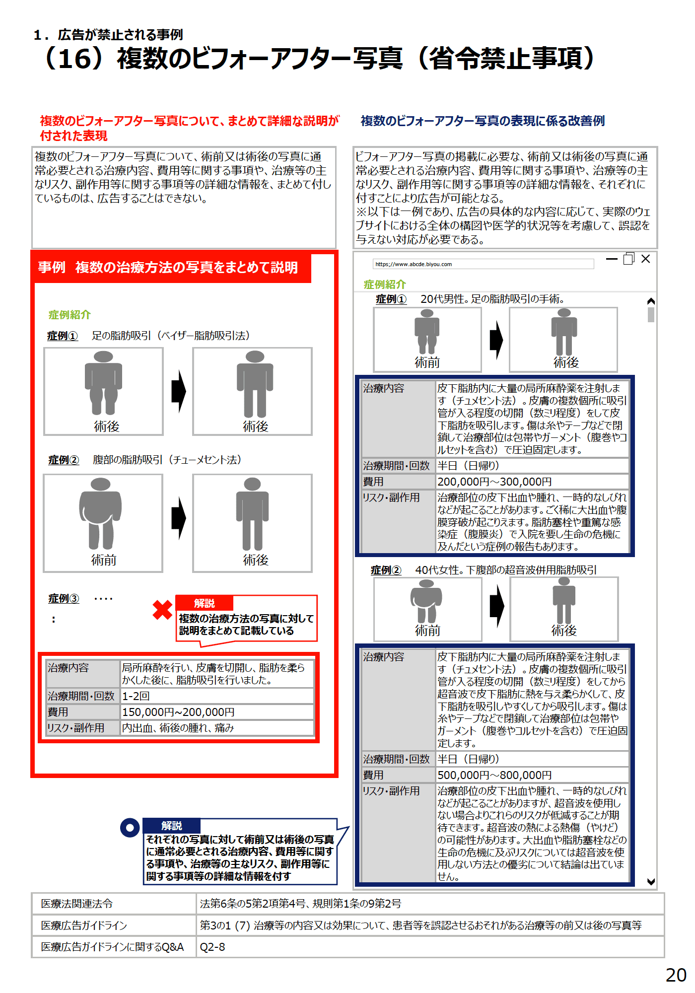 (16)複数のビフォーアフター写真(省令禁止事項) - 医療広告規制におけるウェブサイトの事例解説書(第2版)