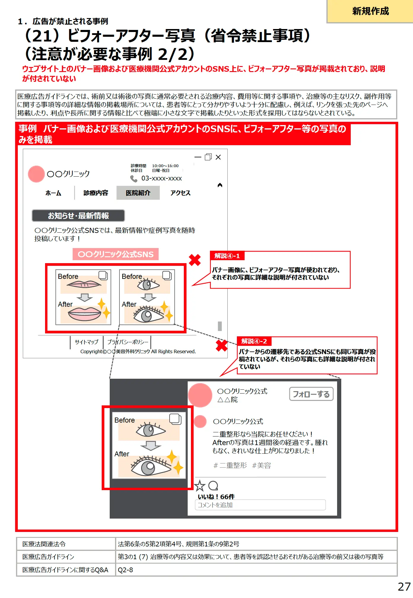 (21)ビフォーアフター写真(省令禁止事項)(注意が必要な事例 2/2) - 医療広告規制におけるウェブサイトの事例解説書(第3版)