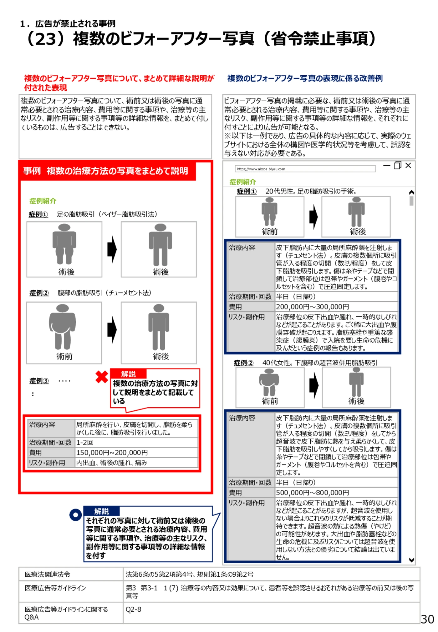 (23)複数のビフォーアフター写真(省令禁止事項) - 医療広告規制におけるウェブサイト等の事例解説書(第6版)