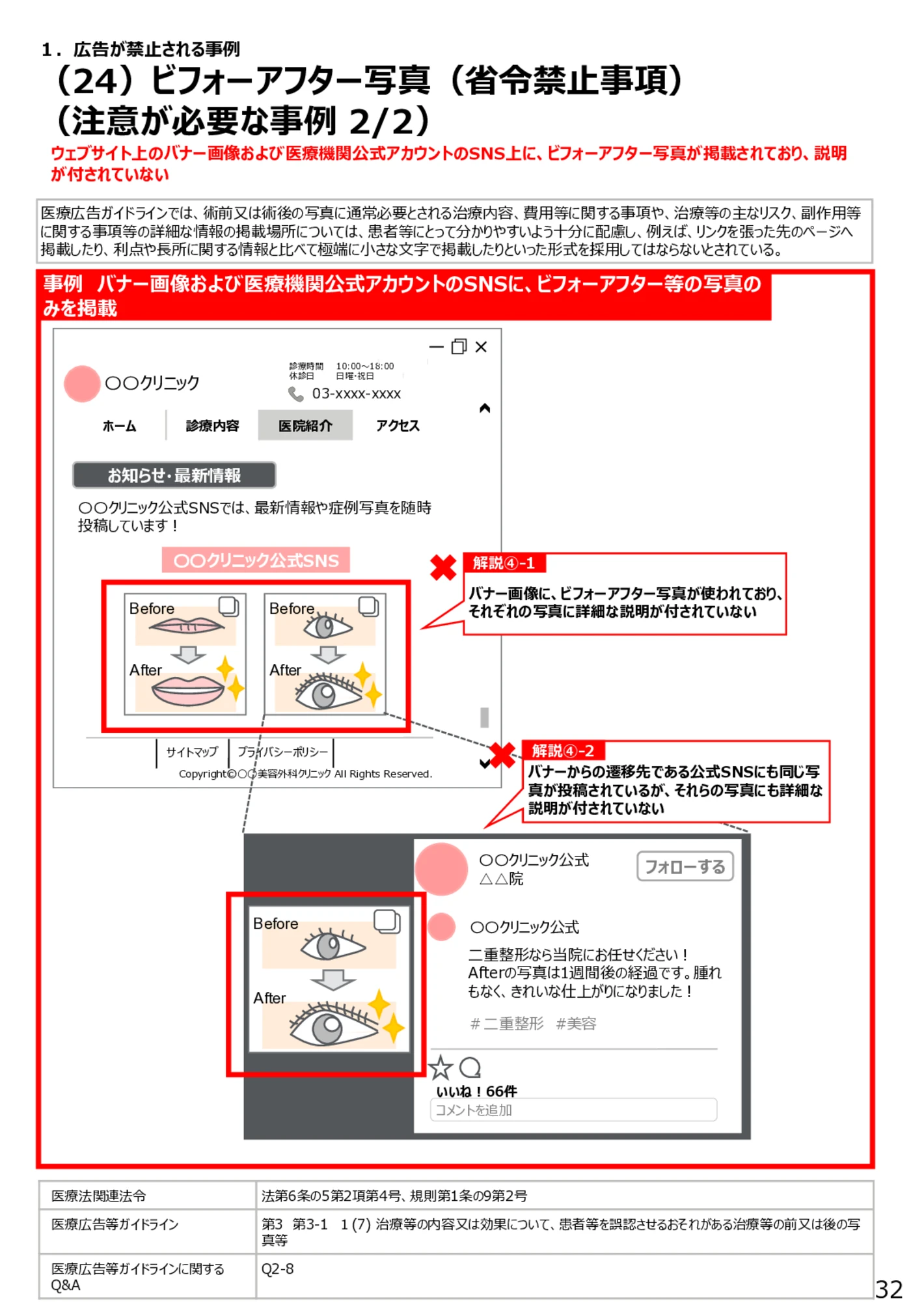 （24）ビフォーアフター写真（省令禁止事項）（注意が必要な事例2/2） - 医療広告規制におけるウェブサイト等の事例解説書（第６版）