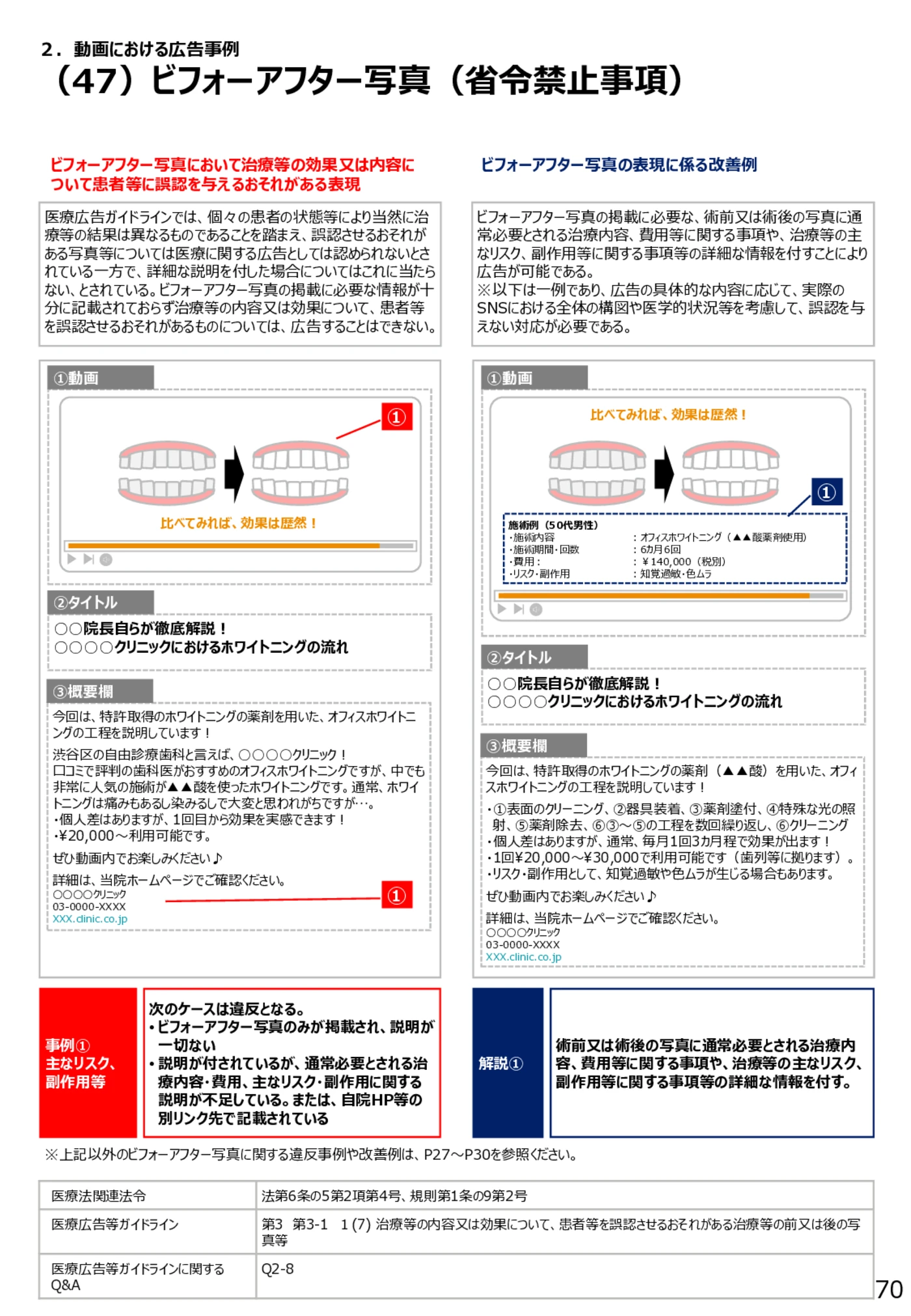 （47）ビフォーアフター写真（省令禁止事項） - 医療広告規制におけるウェブサイト等の事例解説書（第６版）